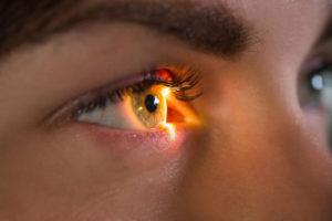 scanning eye close-up, retinal diagnostics in ophthalmology glaucoma diagnosis.