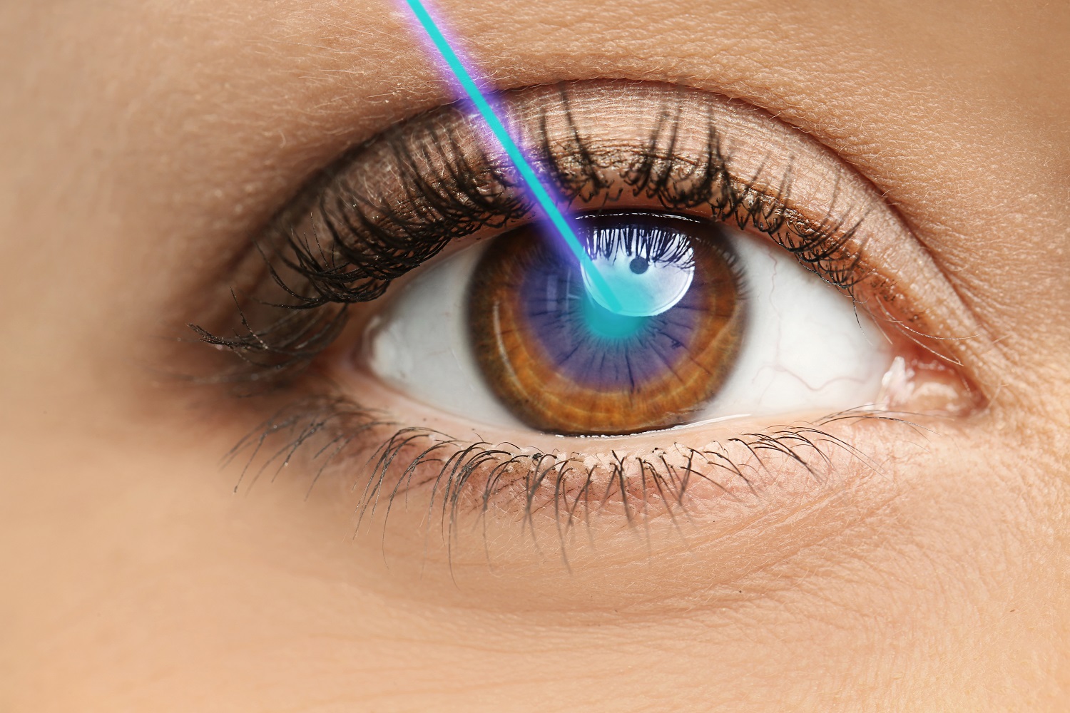 The Top Laser Eye Surgery Faq Are You Awake During Lasik Surgery